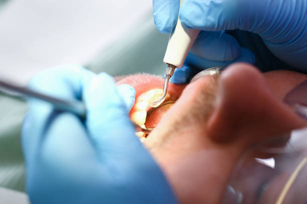 Best Emergency Root Canal Treatment in Wallis, TX