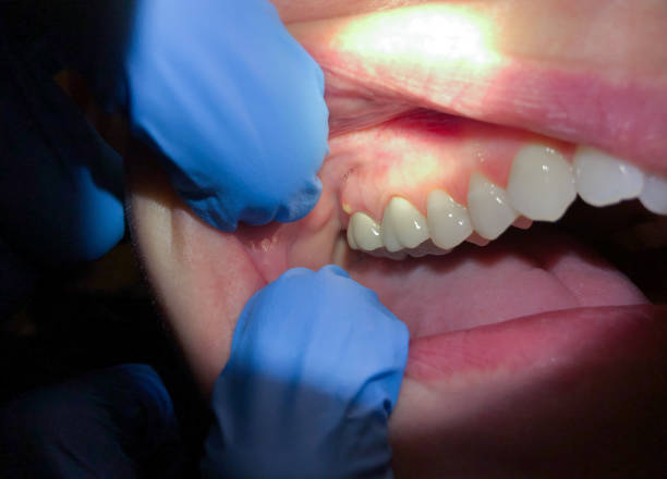 Best After-Hours Dental Trauma Care in Wallis, TX