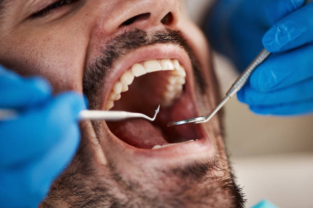 Best Emergency Gum Treatment in Wallis, TX