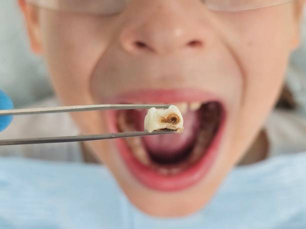 Best Same-Day Emergency Dental Services in Wallis, TX